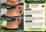 Vedas Cure Lipoma Treatment Reviews