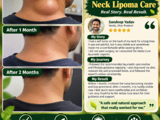 Neck-Lipoma-Care_