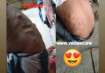 Vedas Cure Lipoma Treatment Reviews